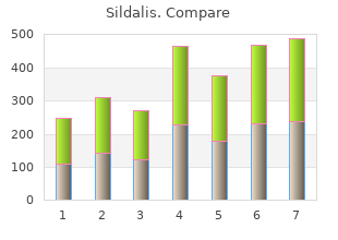 order on line sildalis