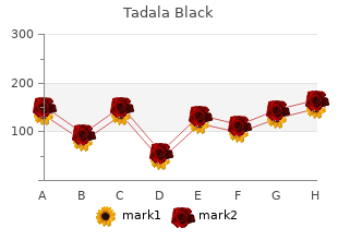 buy 80 mg tadala_black mastercard