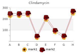 buy clindamycin in united states online