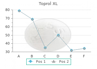 generic toprol xl 25 mg