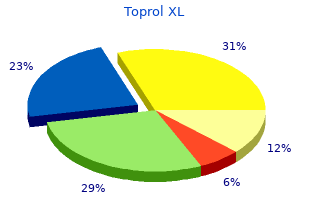 discount 100 mg toprol xl fast delivery