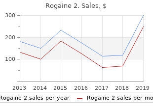 buy generic rogaine 2 60 ml on line