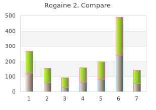 buy on line rogaine 2