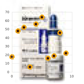 Chromosome 10, trisomy 10q