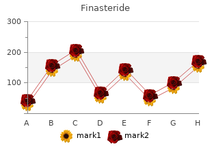 buy finasteride 1 mg with amex