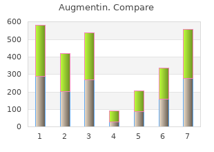 375 mg augmentin sale