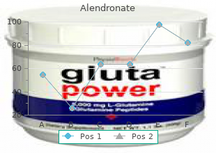 cheap alendronate 70mg free shipping