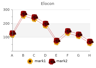 generic elocon 5g