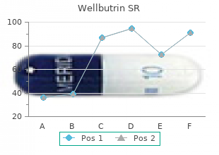 discount 150 mg wellbutrin sr mastercard