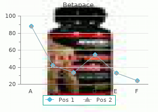 cheap betapace express