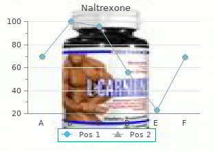 discount naltrexone express